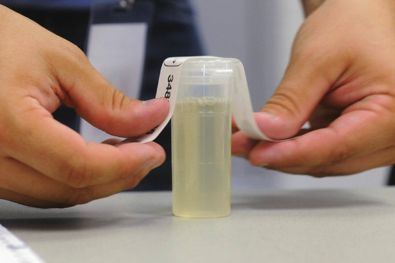How To Store Pee For Drug Test?