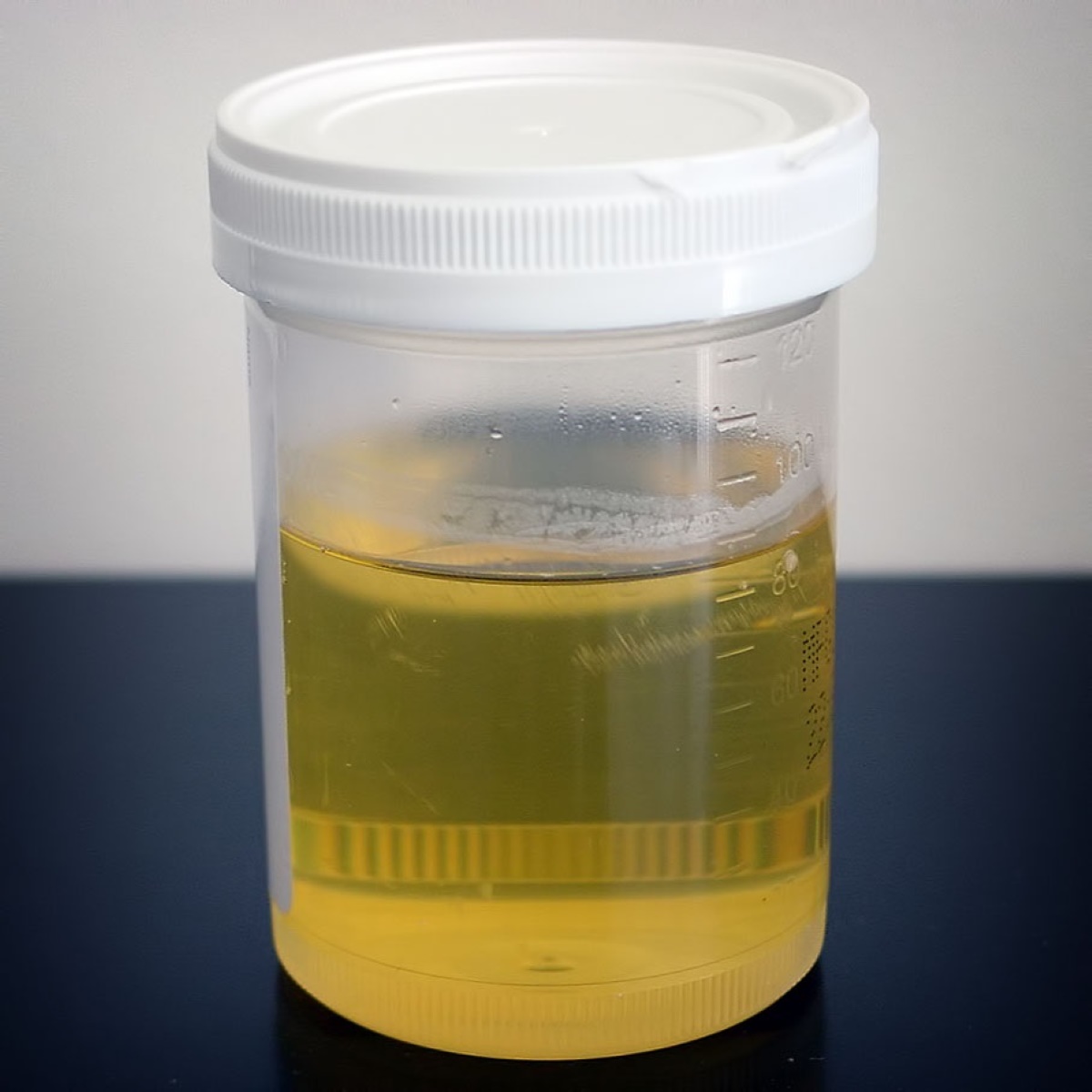 How To Store Urine For A Drug Test