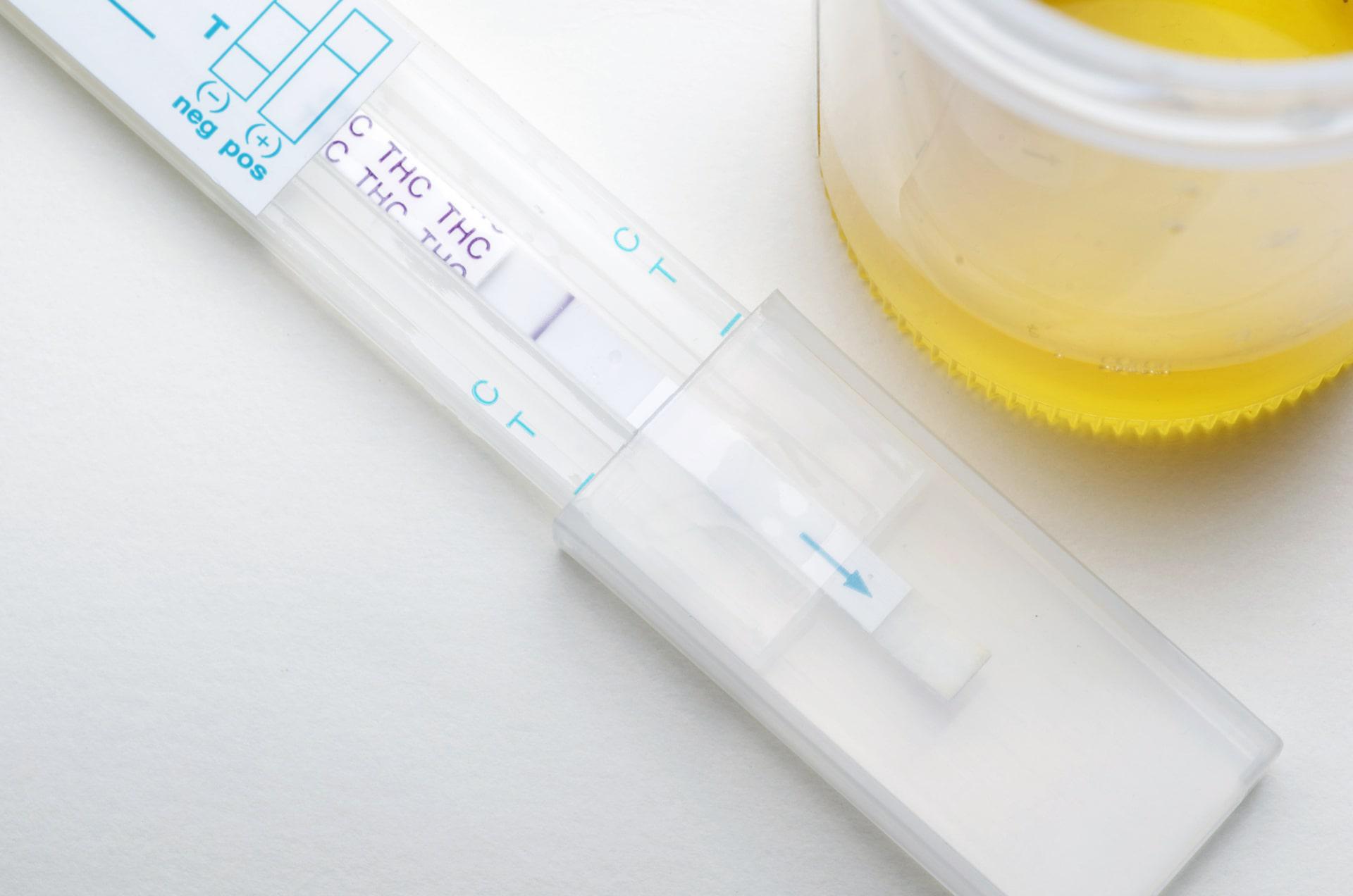 How To Store Urine For Drug Test