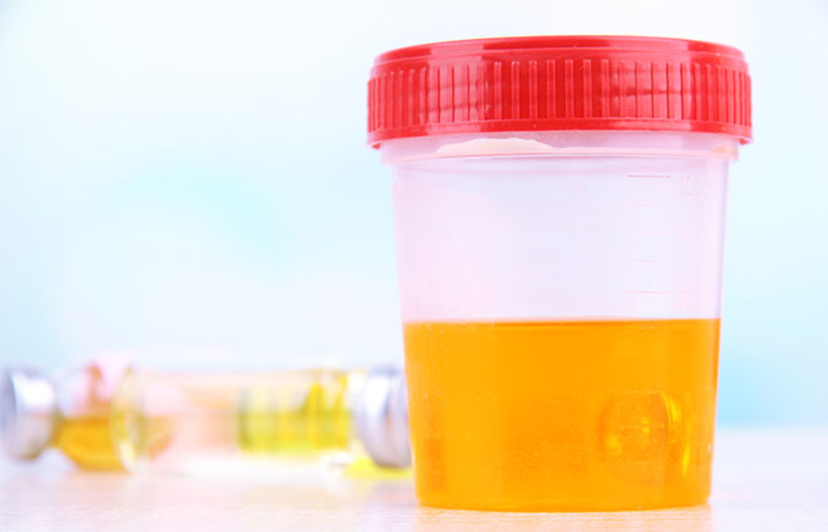 How To Store Urine Overnight For Drug Test