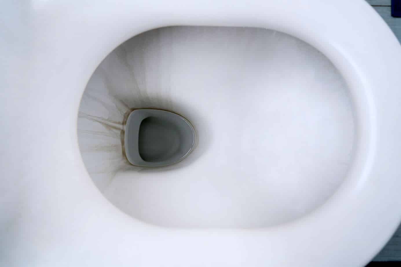 How Do You Remove Hard Water Stains From Toilet Bowl