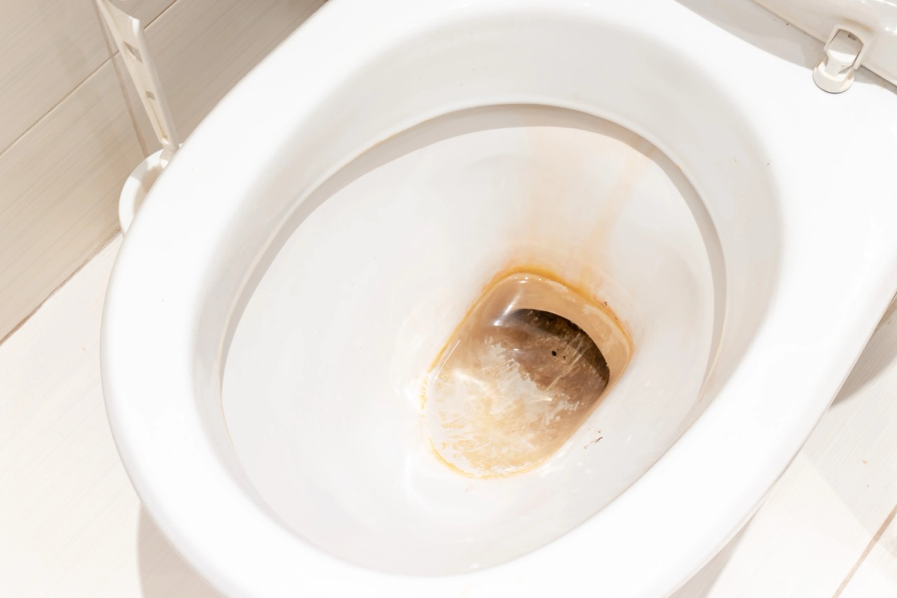 How To Clean Yellow Stained Toilet Bowl