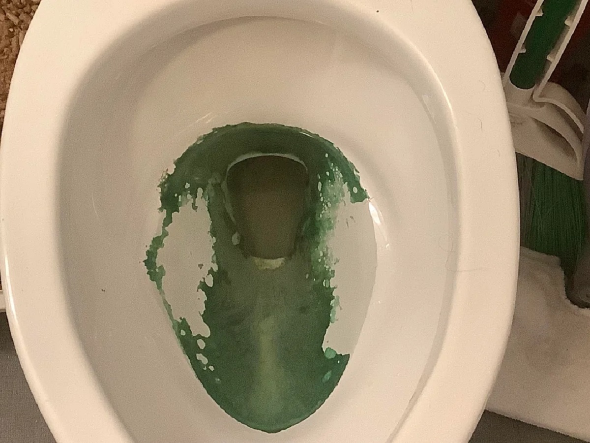 How To Get Rid Of Green Stains In Toilet Bowl