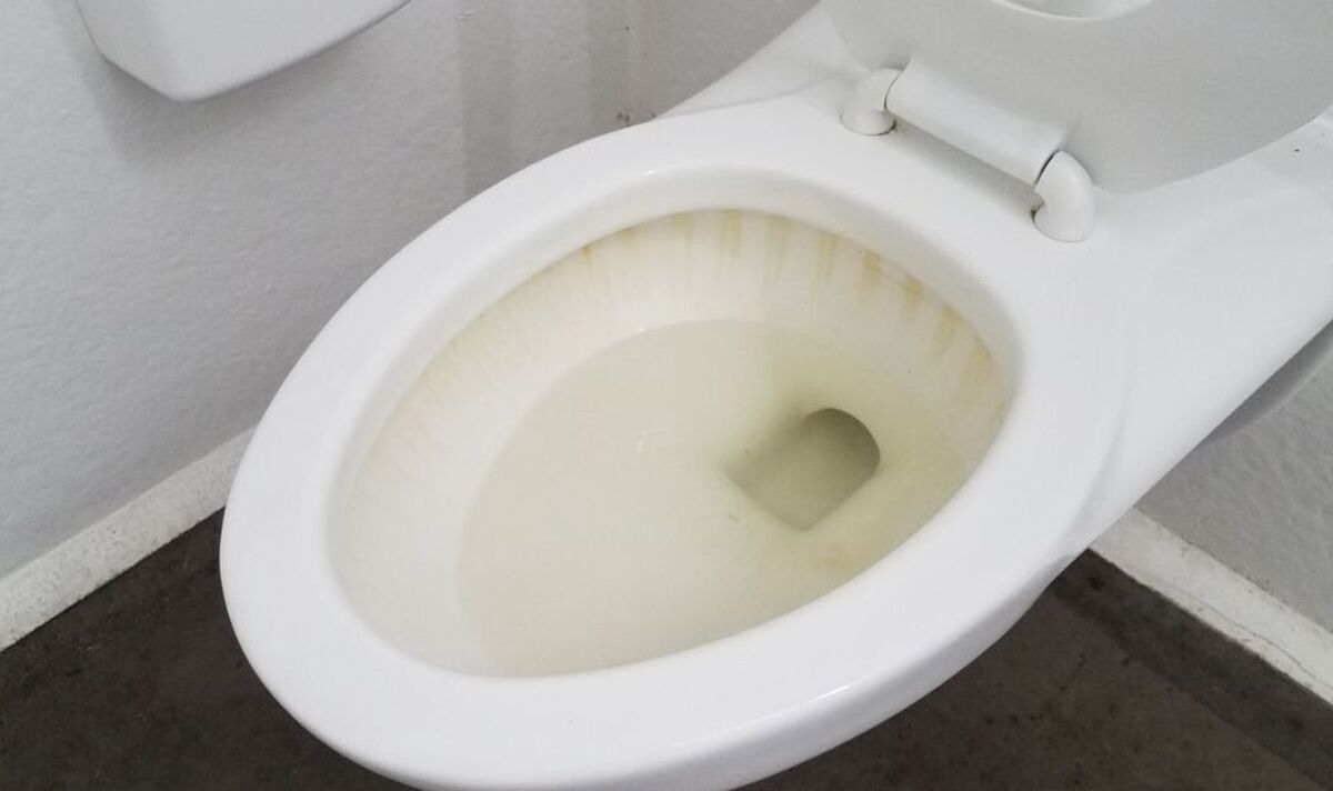 How To Get Rid Of Yellow Stain On Toilet Seat
