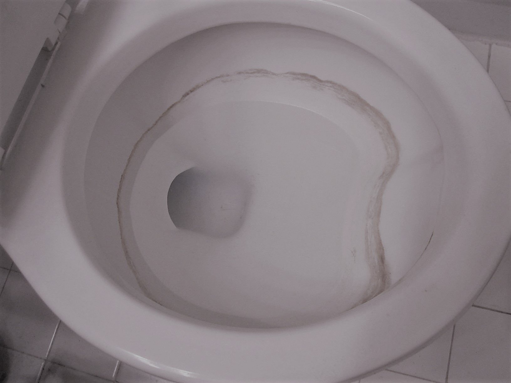 What Causes Grey Stains In Toilet Bowl