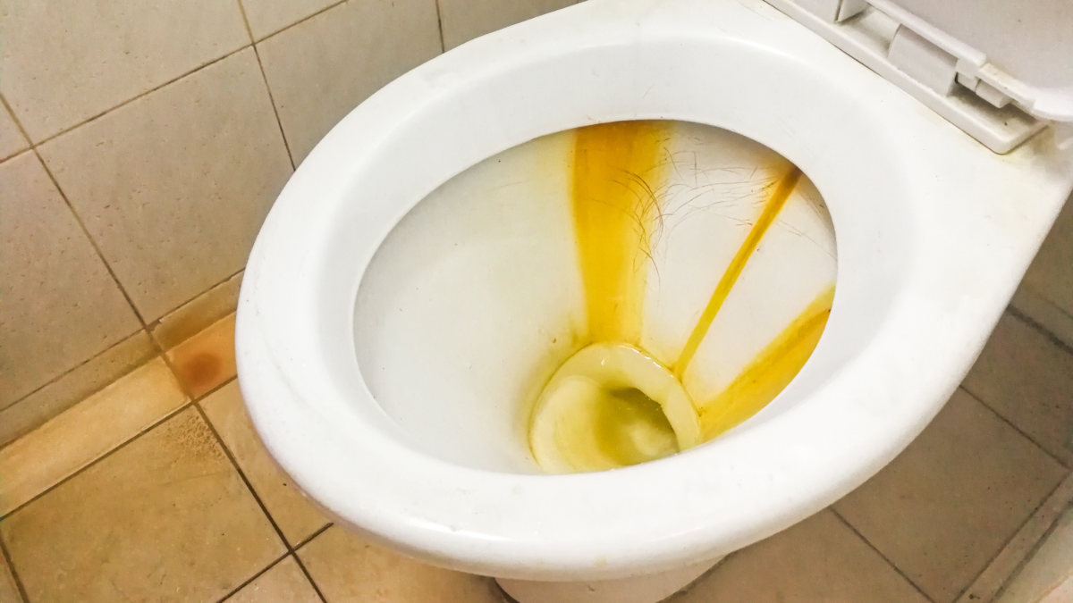 What Causes Toilet Bowl Stains