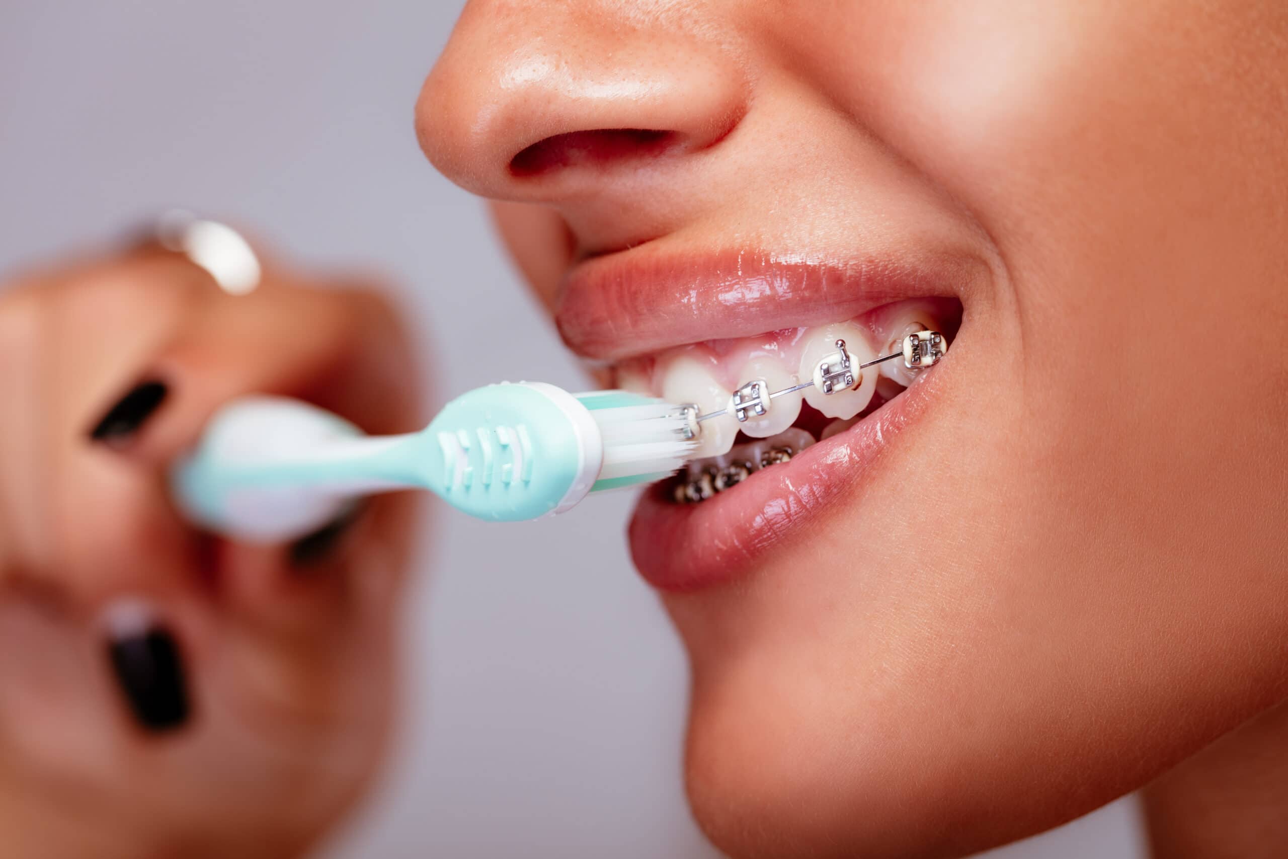 What Toothbrush Is Best For Braces